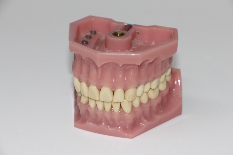 Best Denture Adhesive for Lower Dentures