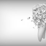 Causes and Consequences of Tooth Loss