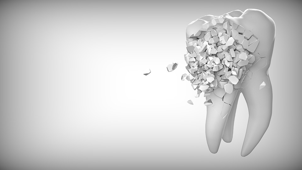 Causes and Consequences of Tooth Loss